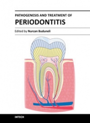 Pathogenesis and Treatment of Periodontitis (pdf)